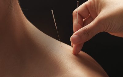 Dry Needling and Osteopathy
